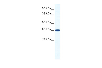 DLX4 Rabbit Polyclonal Antibody