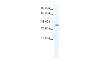 HOXB1 Rabbit Polyclonal Antibody
