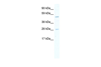 ASCL2 Rabbit Polyclonal Antibody