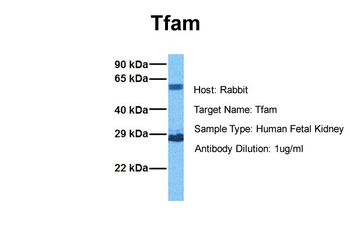 TFAM Rabbit Polyclonal Antibody