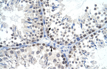 Tfam Rabbit Polyclonal Antibody