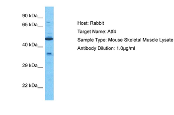 ATF4 Rabbit Polyclonal Antibody