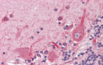 ATF4 Rabbit Polyclonal Antibody
