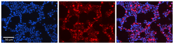 ATF4 Rabbit Polyclonal Antibody