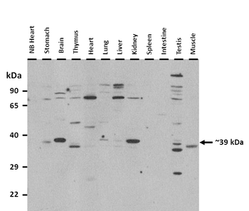 Atf4 Rabbit Polyclonal Antibody
