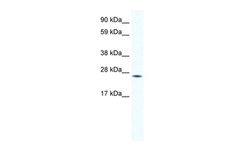 HOXB7 Rabbit Polyclonal Antibody