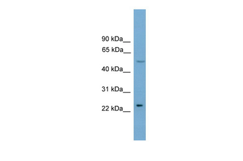 Klf4 Rabbit Polyclonal Antibody