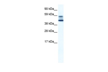 ZBTB7A Rabbit Polyclonal Antibody