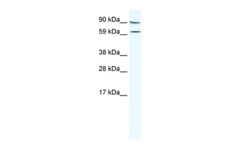 MTA2 Rabbit Polyclonal Antibody