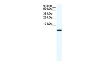 CCL5 Rabbit Polyclonal Antibody