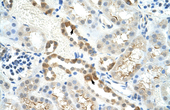 MYBBP1A Rabbit Polyclonal Antibody