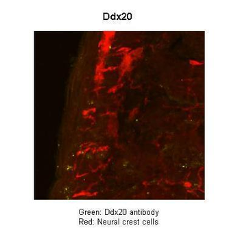 Ddx20 Rabbit Polyclonal Antibody