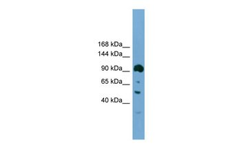 Ddx20 Rabbit Polyclonal Antibody