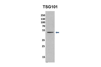 TSG101 Rabbit Polyclonal Antibody