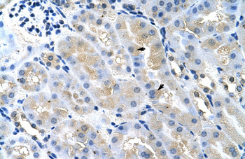 TSG101 Rabbit Polyclonal Antibody
