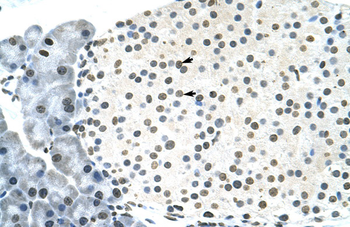 RNF6 Rabbit Polyclonal Antibody