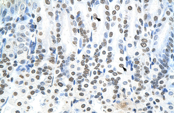 RNF6 Rabbit Polyclonal Antibody