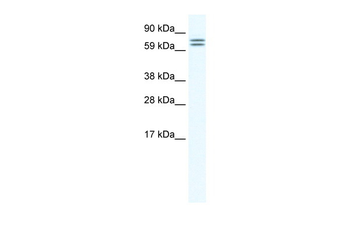 CES6 Rabbit Polyclonal Antibody