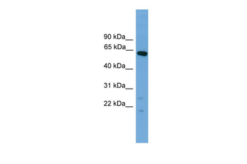 Tbx22 Rabbit Polyclonal Antibody