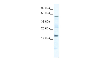 CSNK1G1 Rabbit Polyclonal Antibody