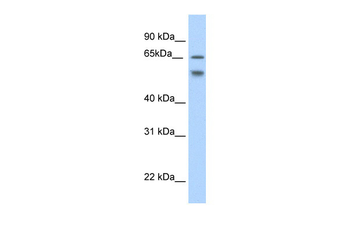 RBM35B Rabbit Polyclonal Antibody