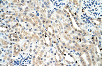 FOXK1 Rabbit Polyclonal Antibody