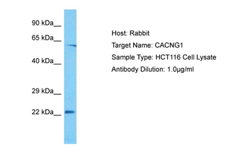 CACNG1 Rabbit Polyclonal Antibody