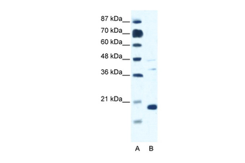 CACNG1 Rabbit Polyclonal Antibody