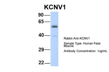 KCNV1 Rabbit Polyclonal Antibody