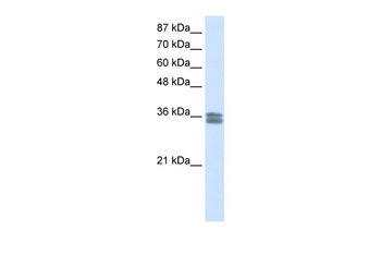 CACNG4 Rabbit Polyclonal Antibody