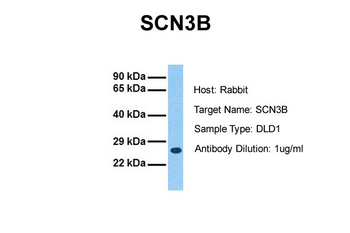 SCN3B Rabbit Polyclonal Antibody