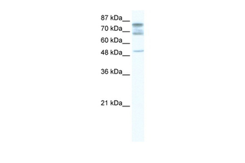 DDX46 Rabbit Polyclonal Antibody