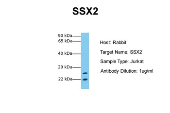 SSX2 Rabbit Polyclonal Antibody