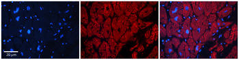 FUBP1 Rabbit Polyclonal Antibody