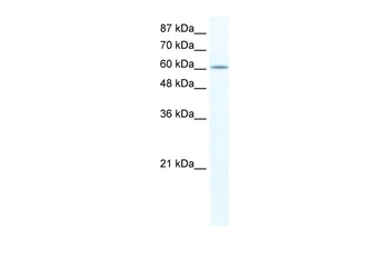 FUBP1 Rabbit Polyclonal Antibody