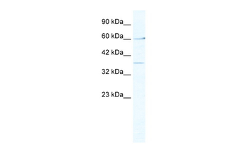 MTA1 Rabbit Polyclonal Antibody