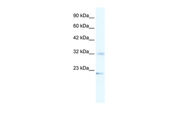 ZNF265 Rabbit Polyclonal Antibody