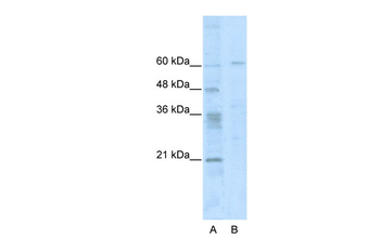 ZNF192 Rabbit Polyclonal Antibody