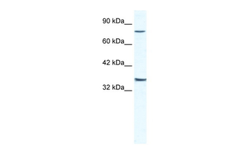 ZNF337 Rabbit Polyclonal Antibody