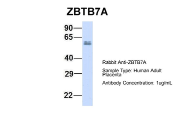ZBTB7A Rabbit Polyclonal Antibody