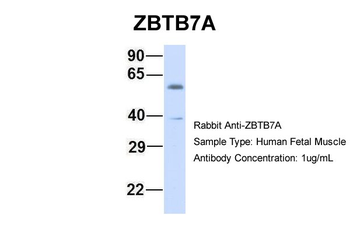 ZBTB7A Rabbit Polyclonal Antibody