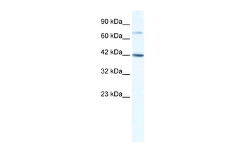 GLI4 Rabbit Polyclonal Antibody