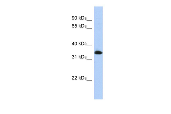 ZNF511 Rabbit Polyclonal Antibody