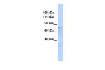 ZFP62 Rabbit Polyclonal Antibody