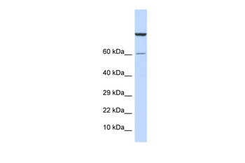 ZNF251 Rabbit Polyclonal Antibody