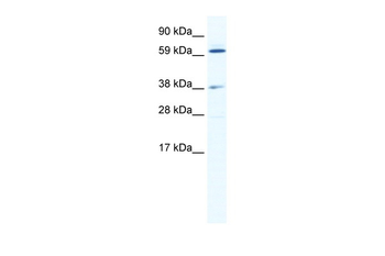 ALX3 Rabbit Polyclonal Antibody