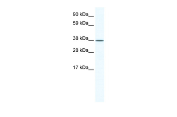 KLF2 Rabbit Polyclonal Antibody