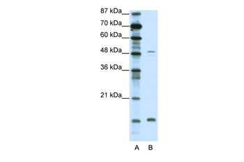 FBN1 Rabbit Polyclonal Antibody