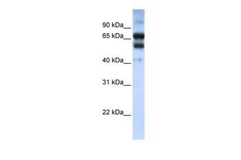RARG Rabbit Polyclonal Antibody