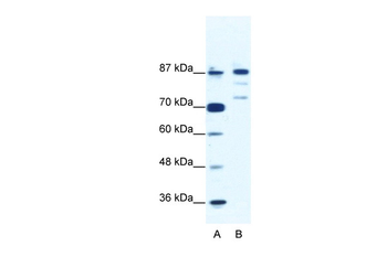 BACH1 Rabbit Polyclonal Antibody